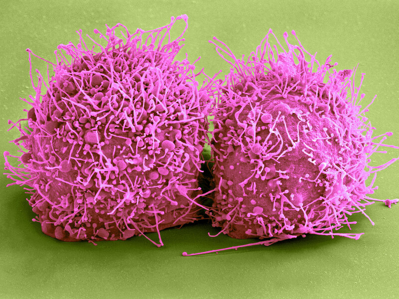 A color-enhanced scanning electron micrograph shows HeLa cells, which are commonly used in biomedical experiments. The research cell line was derived from cervical cancer cells taken from Henrietta Lacks in 1951. (Science Source)