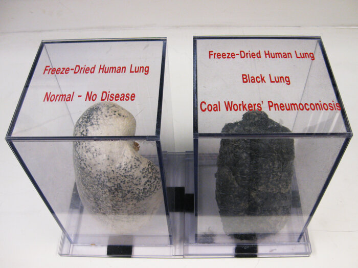 black-lung-display-edit-62f8859fdf7947f25bb389dd4bde094bae966c67-s700-c85.jpg