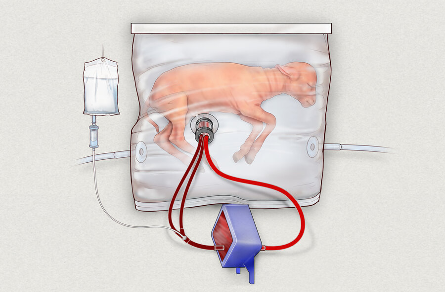Image result for Scientists create artificial womb