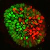 Scientists Make Model Embryos From Stem Cells To Study Key Steps In Human Development