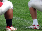 A calf comparison between Thomas Hamilton, left, and one of his teammates. A calf comparison between Thomas Hamilton, left, and one of his teammates.