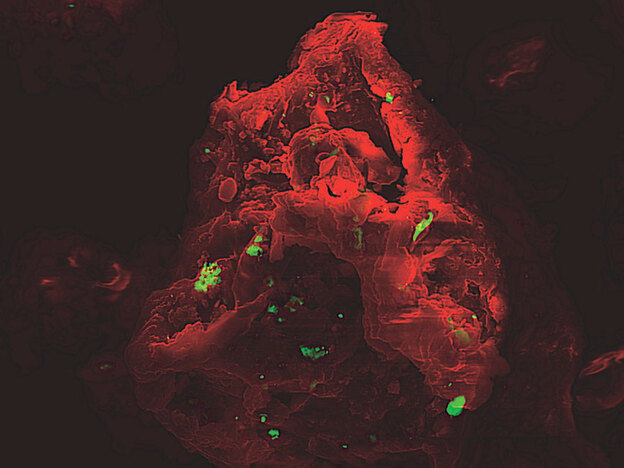 A microscopic image of a dust particle.