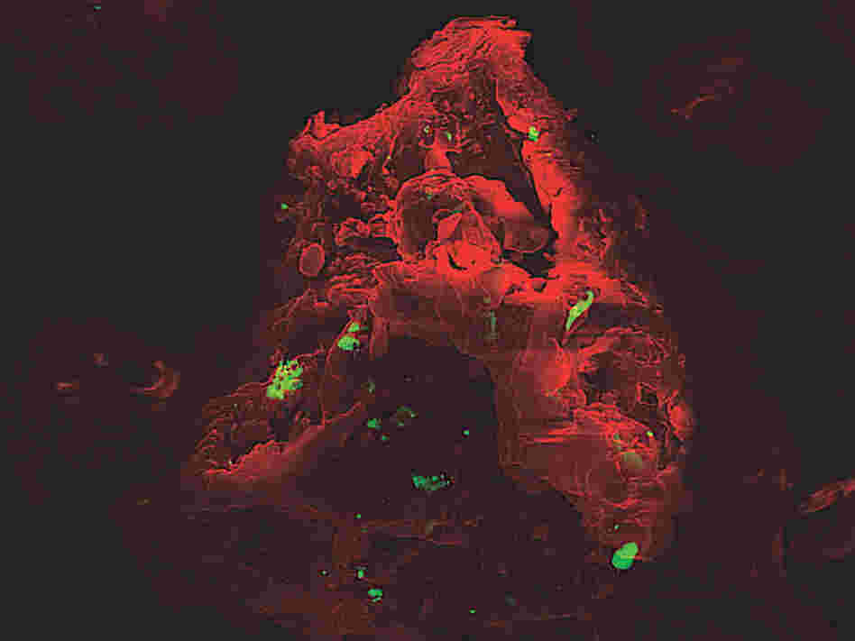 A microscopic image of a dust particle.