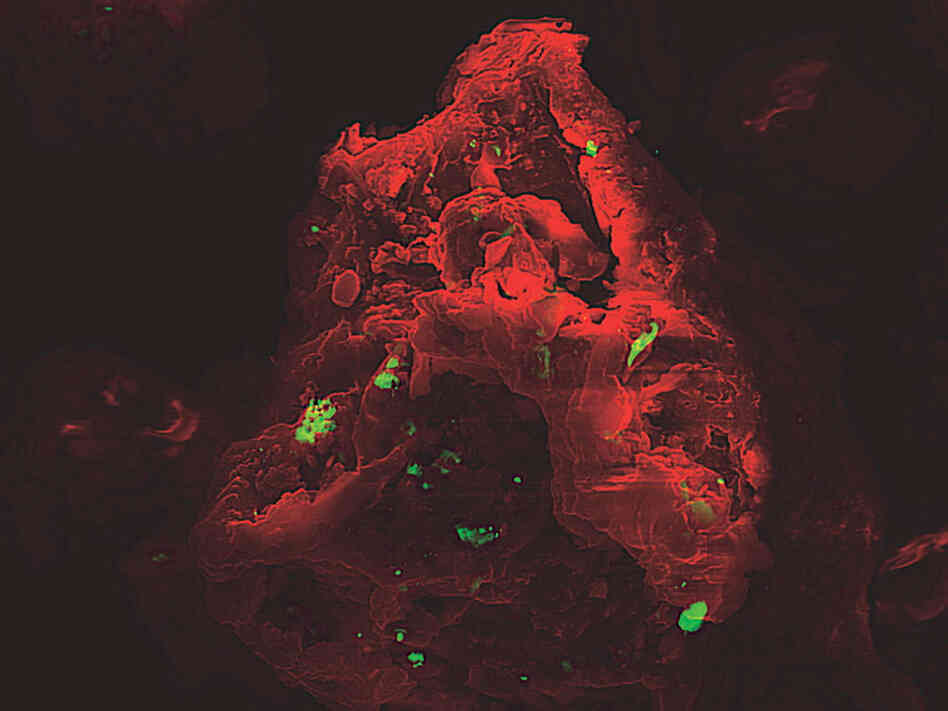 A microscopic image of a dust particle.
