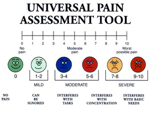 The Wong-Baker facial grimace scale. The Wong-Baker facial grimace scale.