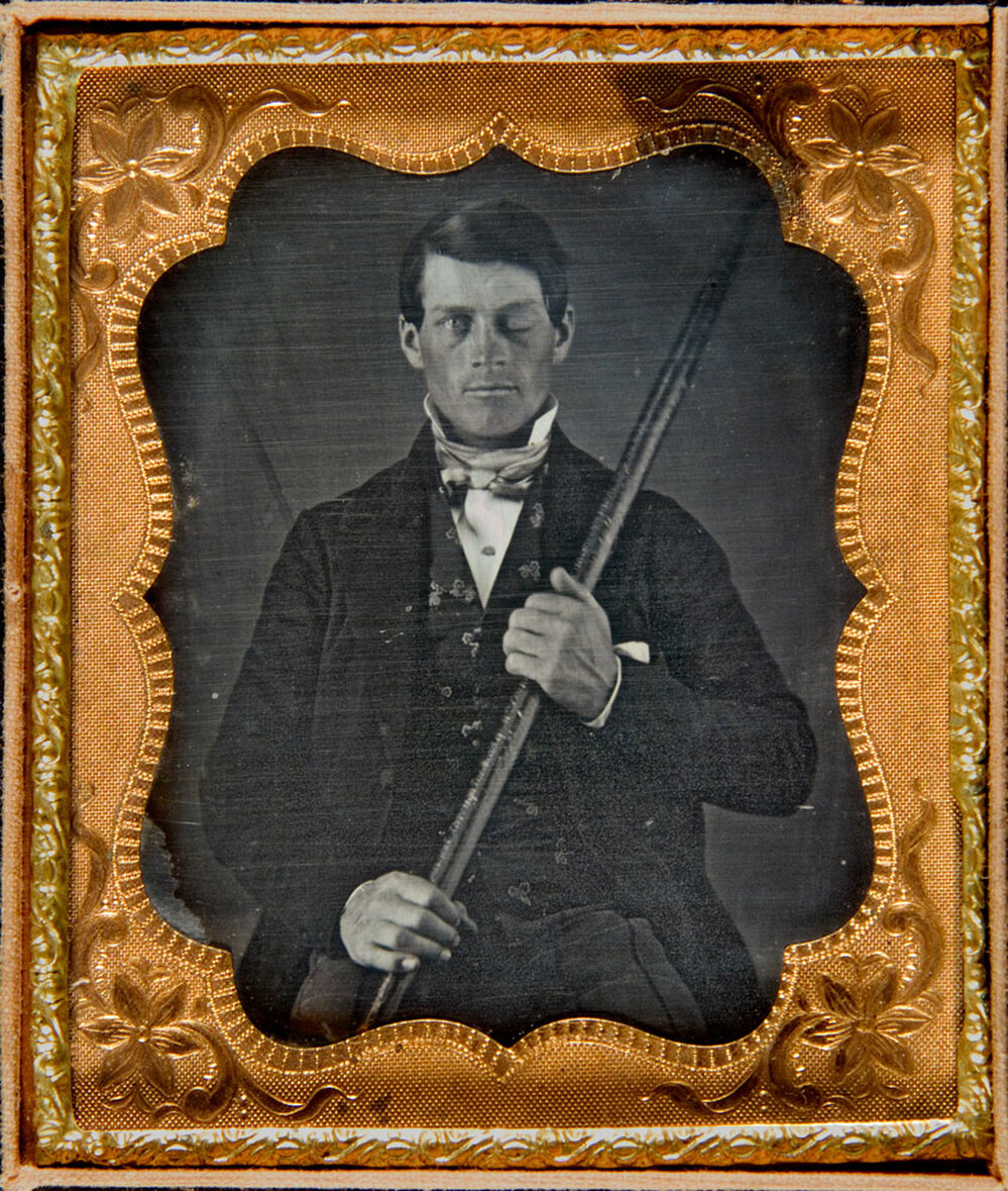 An image believed to be that of Phineas Gage