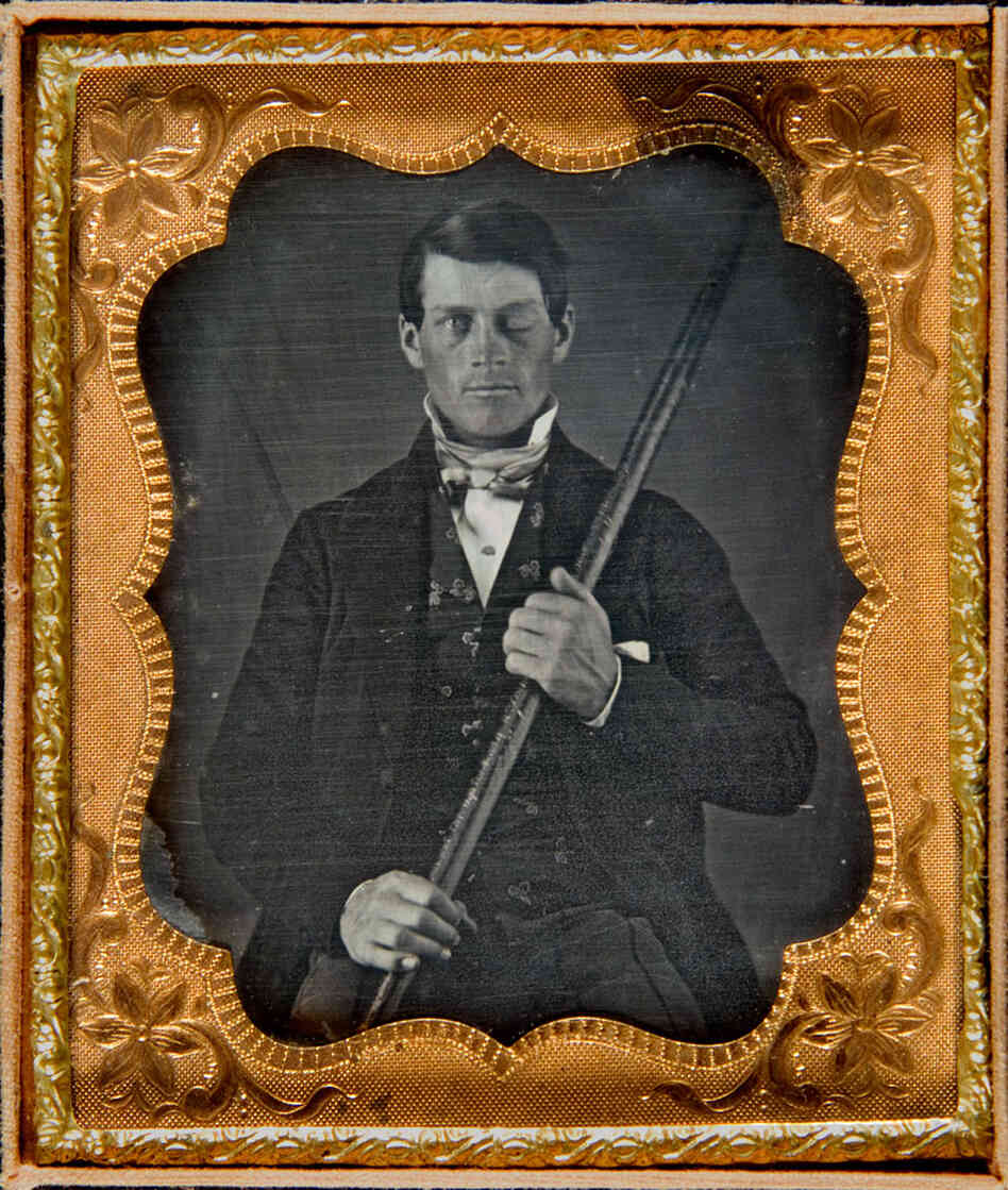 An image believed to be that of Phineas Gage