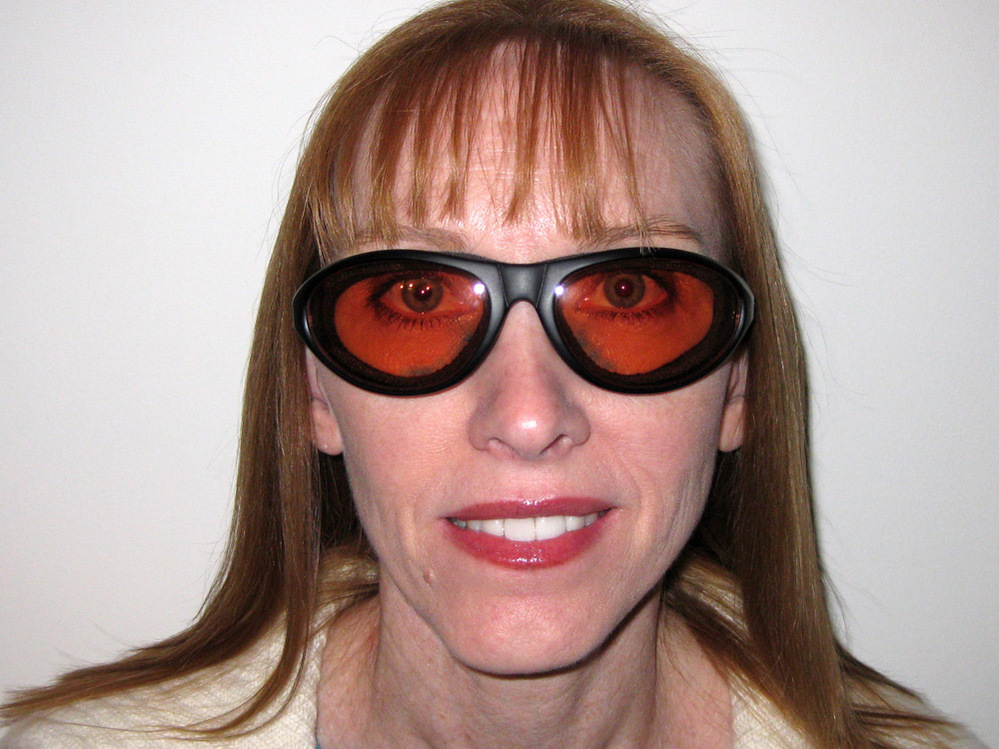 Paula Cofer wears protective goggles due to complications with Lasik.