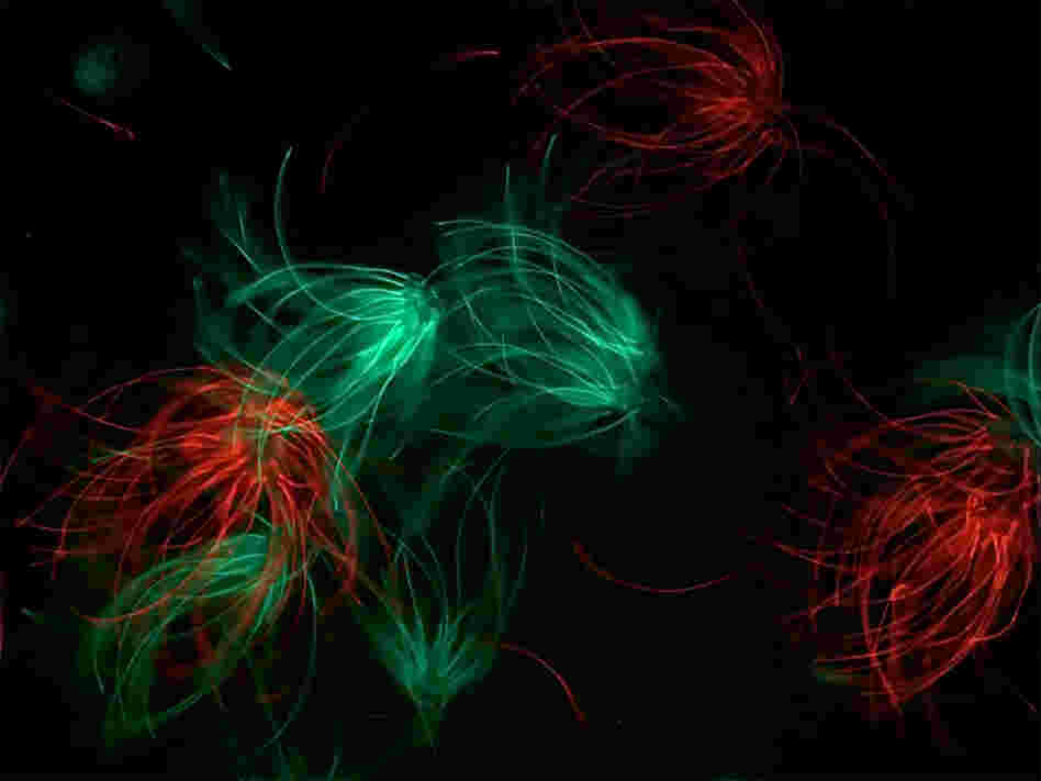 Deer mouse sperm, dyed different colors.
