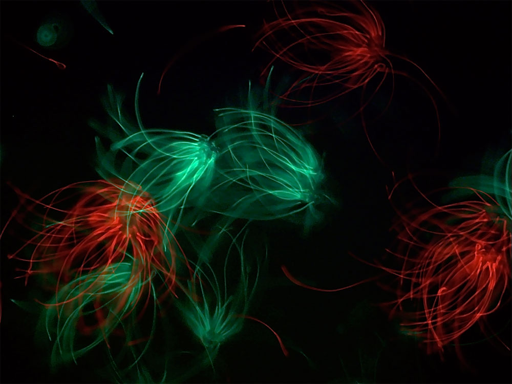 Deer mouse sperm, dyed different colors.