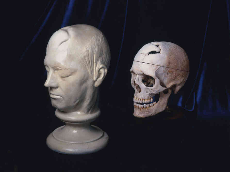 Gage's skull and life mask. Warren Anatomical Museum, Francis A. Countway Library of Medicine