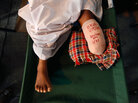 A message covers a bandage on an amputated leg A message covers a bandage on an amputated leg