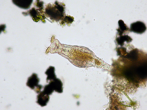 A bdelloid rotifer.