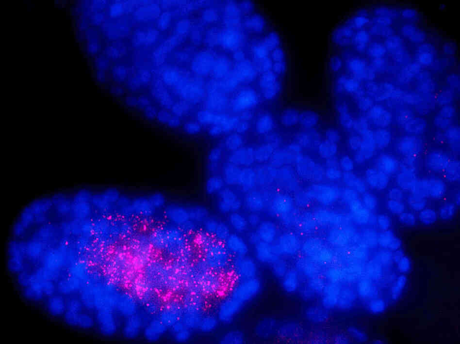 These nematode worm embryos are genetically identical but do not look exactly the same.