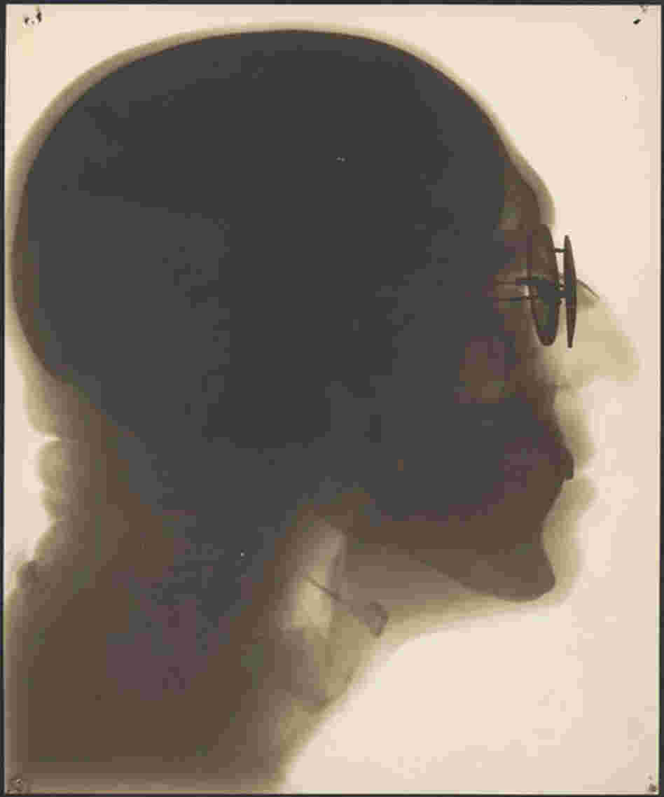 Self-portrait, radiograph, circa 1930s. In this contact print created from X-ray film, you Self-portrait, radiograph, circa 1930s. In this contact print created from X-ray film, you
