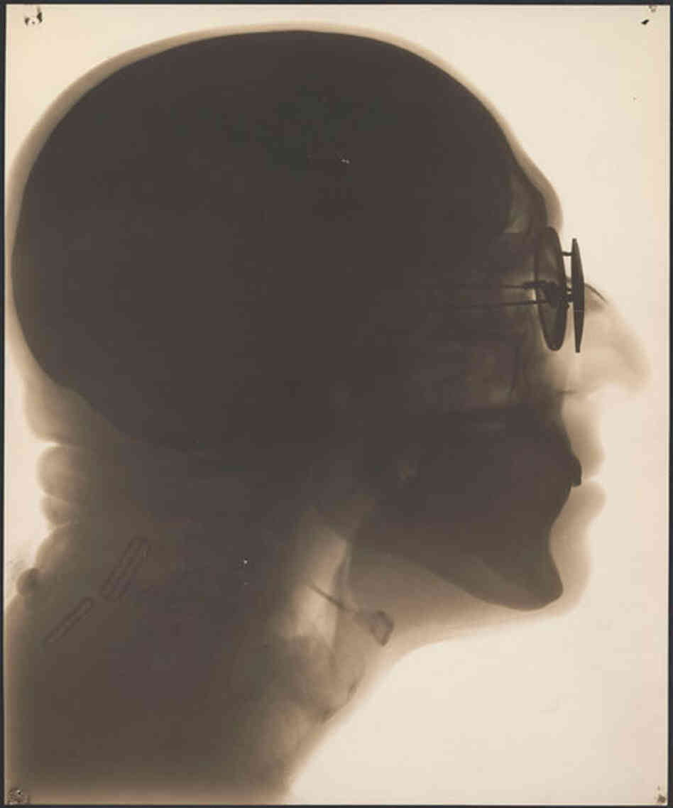 Self-portrait, radiograph, circa 1930s. In this contact print created from X-ray film, you Self-portrait, radiograph, circa 1930s. In this contact print created from X-ray film, you