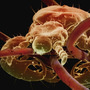 A close-up image of a louse, clinging to human hair.