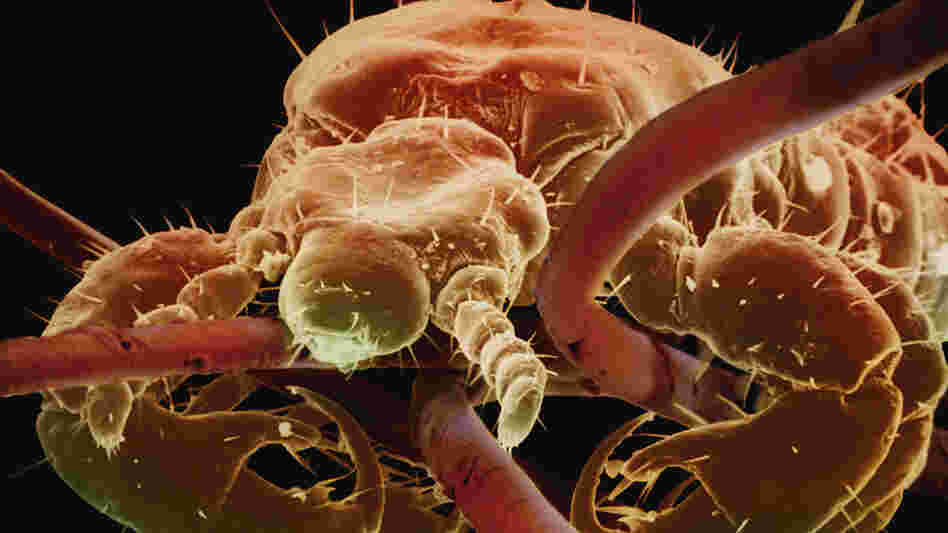 A close-up image of a louse, clinging to human hair. A close-up image of a louse, clinging to human hair.