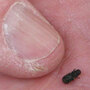 The tiny mountain pine beetle infects the pine trees. The tiny mountain pine beetle infects the pine trees.
