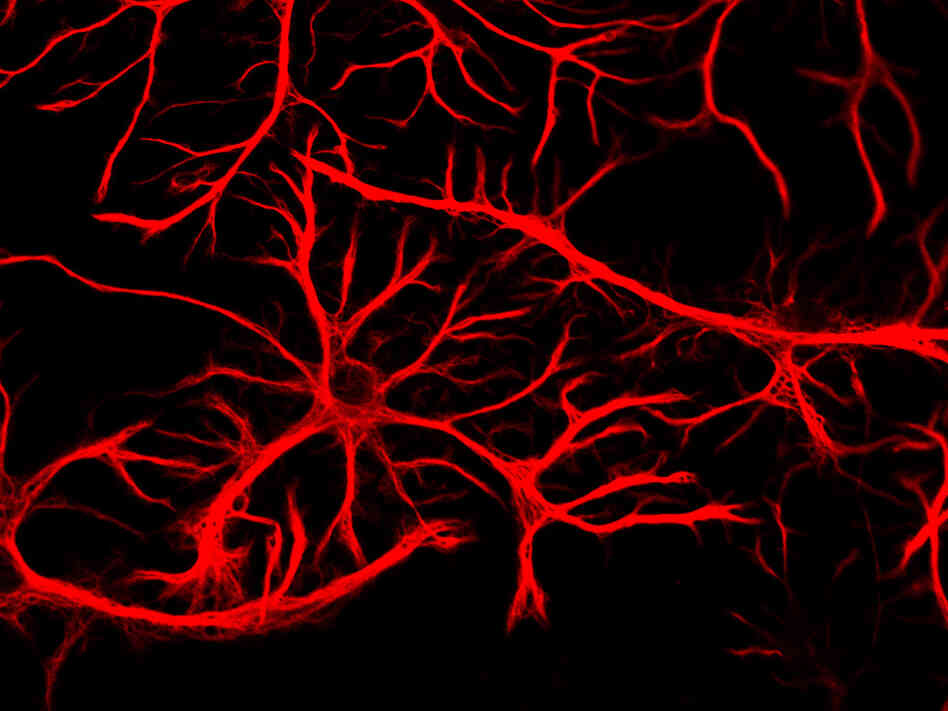 Astrocytes appear star-like after they're stained.