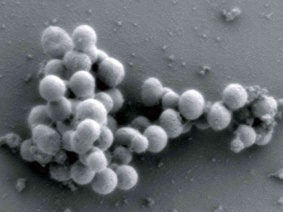 Craig Venter and his team planted a synthetic M. mycoides genome into these yeast cells.