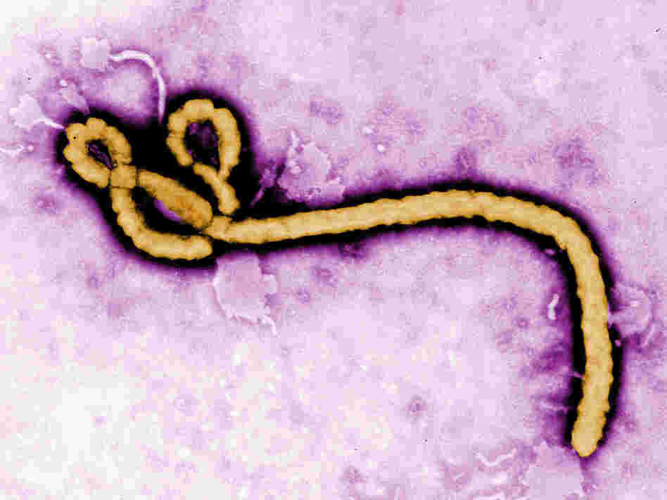 The ultrastructural morphology displayed by an Ebola virus virion.