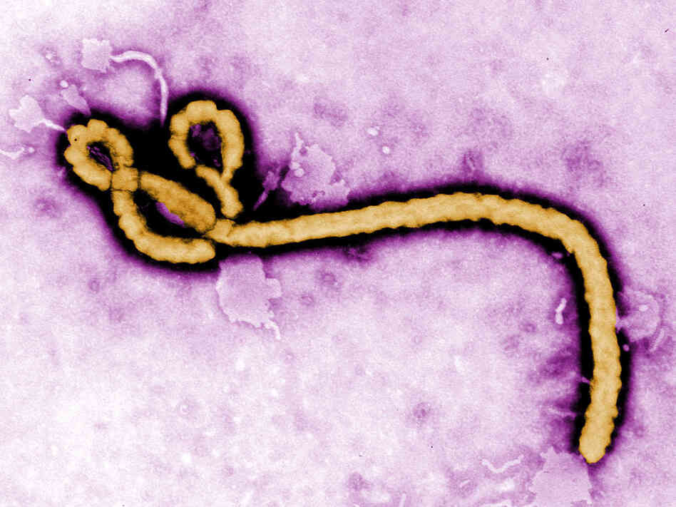 The ultrastructural morphology displayed by an Ebola virus virion.