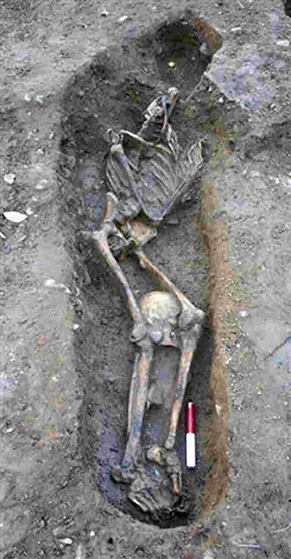 A skeleton unearthed at a site in York in Northern England A skeleton unearthed at a site in York in Northern England