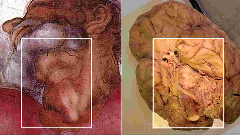 The comparison of God's neck in Michelangelo's painting with a picture of the brain. The comparison of God's neck in Michelangelo's painting with a picture of the brain.