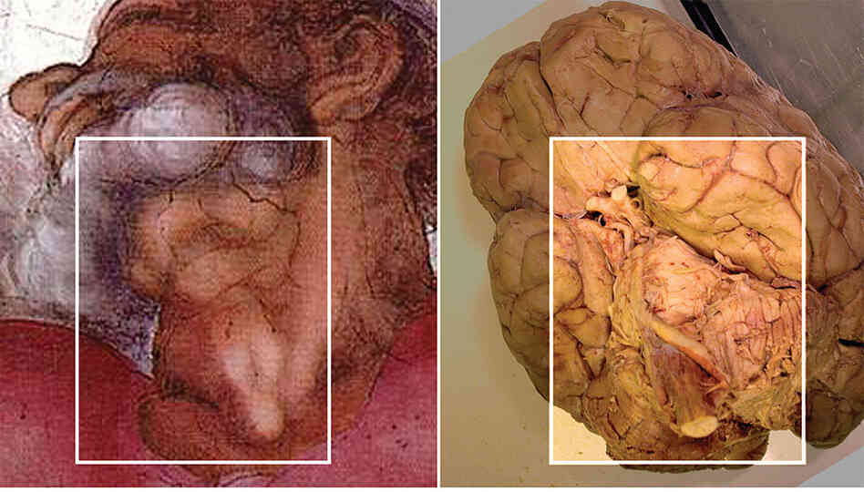 The comparison of God's neck in Michelangelo's painting with a picture of the brain. The comparison of God's neck in Michelangelo's painting with a picture of the brain.