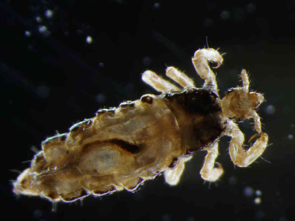 Body louse