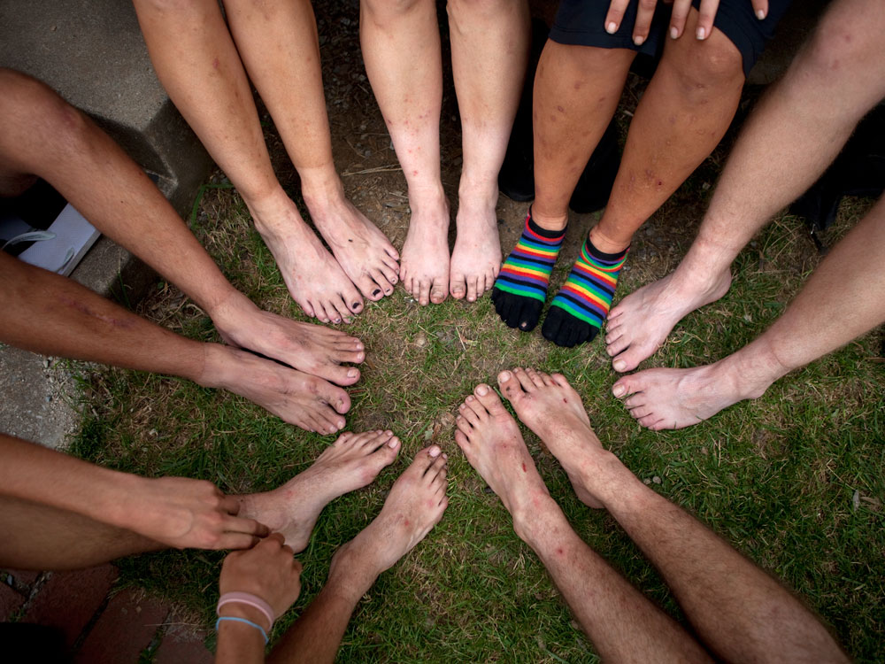 Hikers show their feet