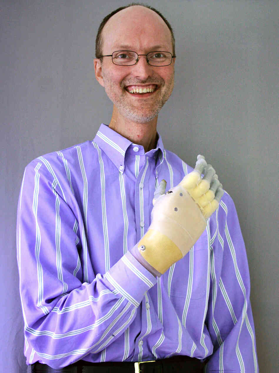 Eric Jones and his bionic hand Eric Jones and his bionic hand