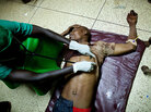 A doctor treats a victim of a bomb blast at Mulago hospital in Kampala late Sunday A doctor treats a victim of a bomb blast at Mulago hospital in Kampala late Sunday