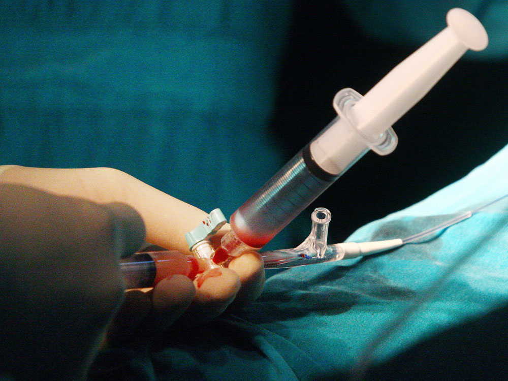 An unidentified western patient receives a stem cell treatment in Bangkok, Thailand.