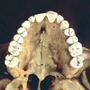 Comparison of chimpanzee, A. afarensis and human denition.