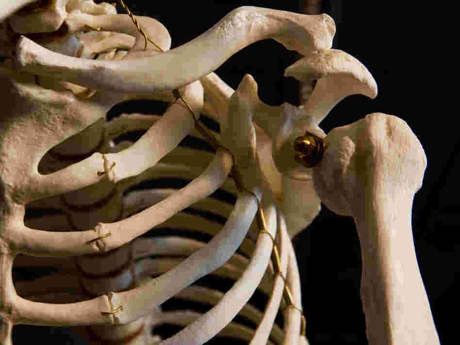 Ape Shoulder