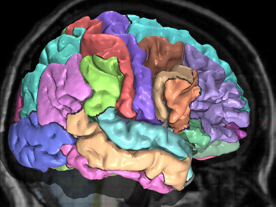 Brain MRI