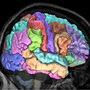 Brain MRI