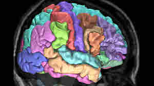 Brain MRI
