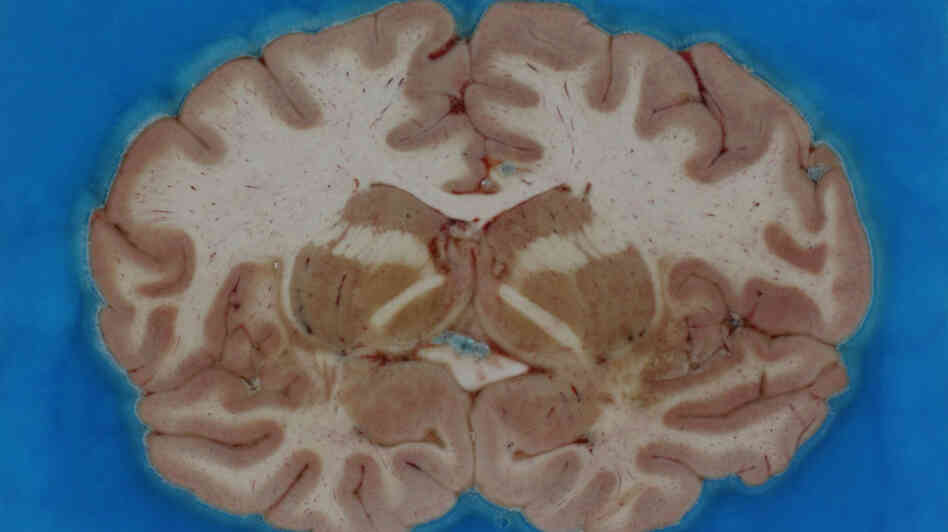 Section of a human brain