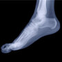 feet