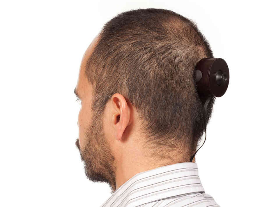 Wafaa Bilal implanted a webcam in the back of his head. The camera is taking a picture a minute for a year and the images are being streamed live at Mathaf, the Arab Museum of Modern Art. 