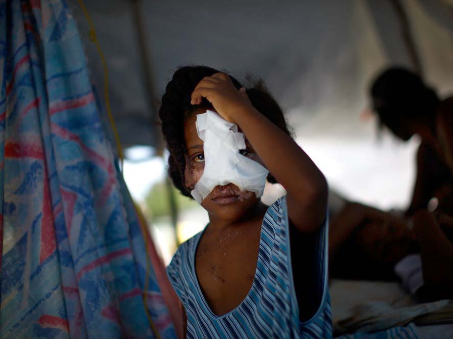 A young, wounded girl in Port-au-Prince, Haiti