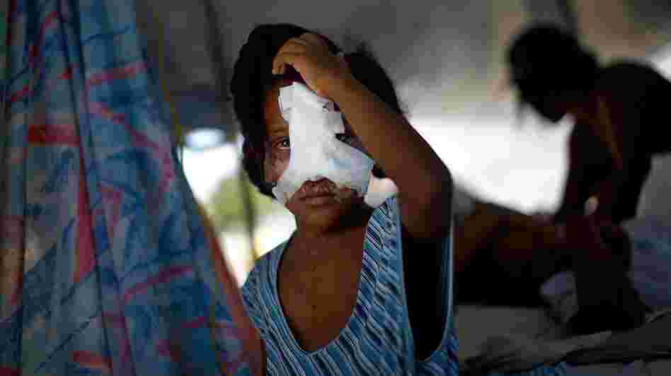 A young, wounded girl in Port-au-Prince, Haiti