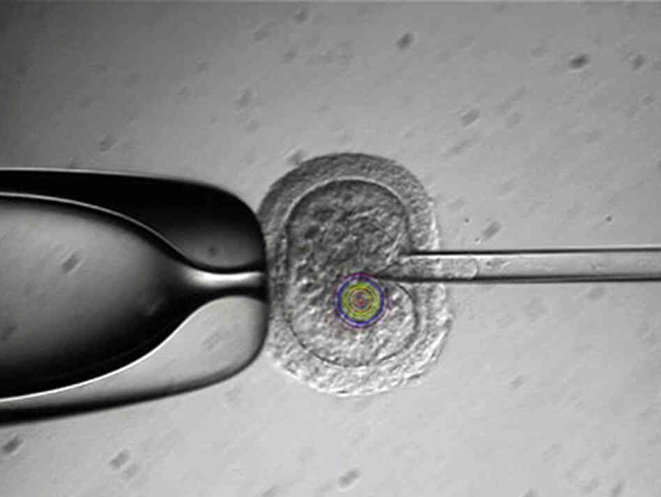 A fertilized monkey egg undergoes a nucleus transplant. A fertilized monkey egg undergoes a nucleus transplant.