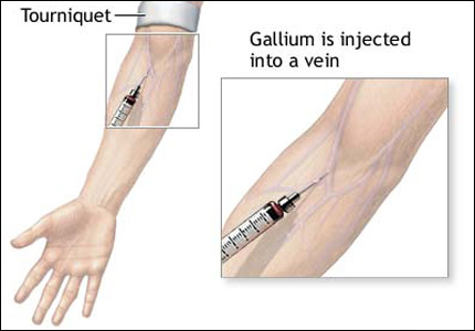 gallium test