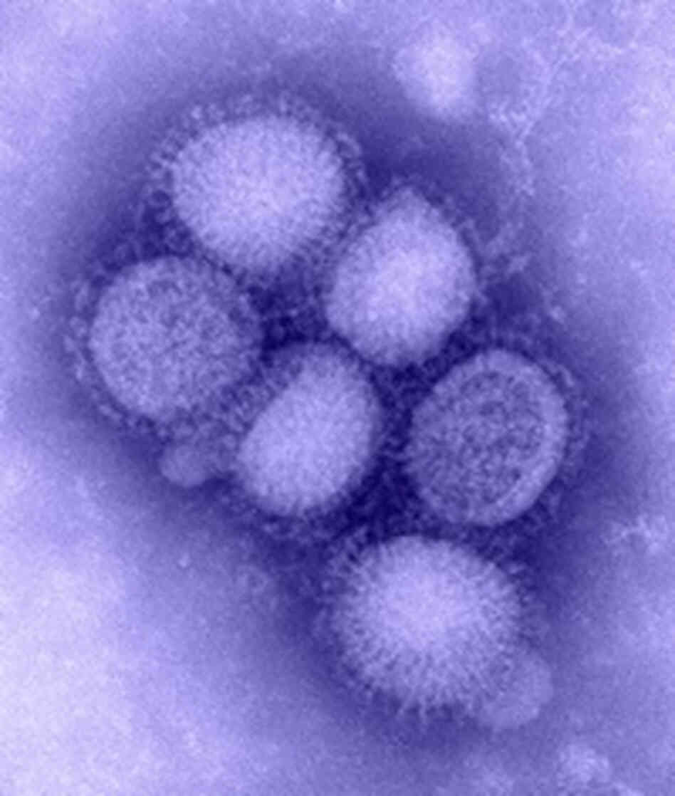 swine flu swine flu