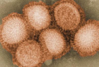 close up of swine flu virus