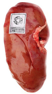 Kidney